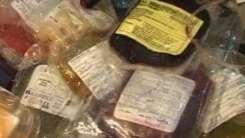 Contaminated blood could have caused Hepatitis