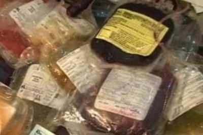 Contaminated blood could have caused Hepatitis