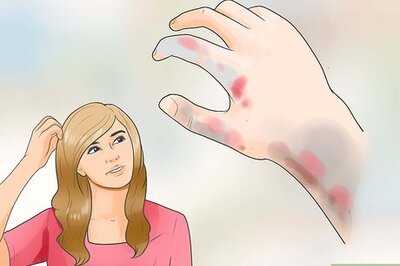 How to Treat a Hydrofluoric Acid Burn