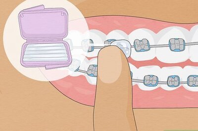 How to Repair Loose, Poking, & Broken Braces Wires