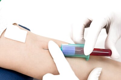 Why You Should Go For A Blood Test Regularly