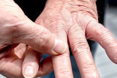 Living Well with Arthritis: Daily Habits for Pain Management and Mobility