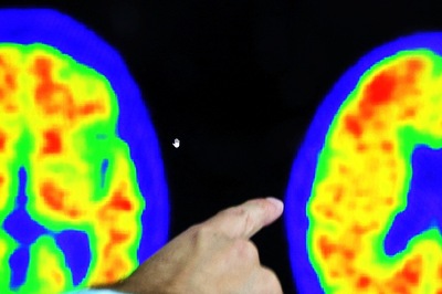 New Study Identifies Gene 'fingerprint' For Brain Ageing, Sheds Light on Memory Decline