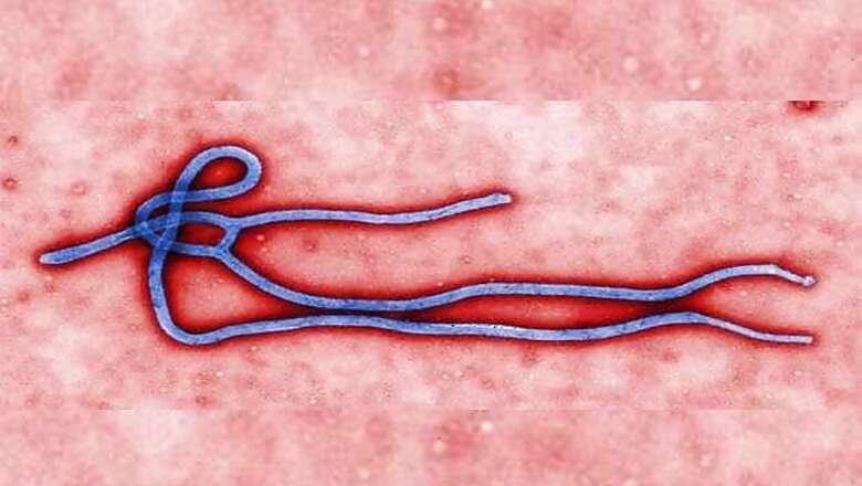 Second Texas healthcare worker tests positive for Ebola