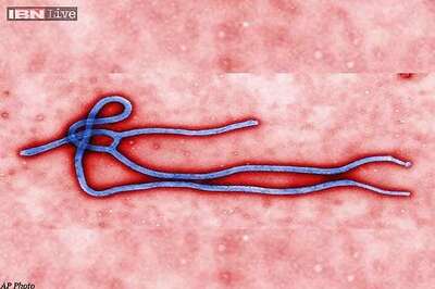 Second Texas healthcare worker tests positive for Ebola
