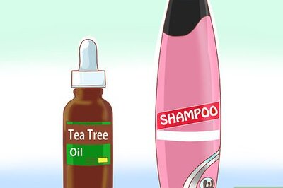 How to Get Rid of Dandruff (Natural Methods)