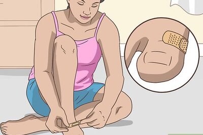 How to Treat a Foot Blister
