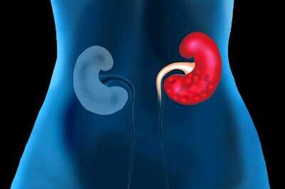 Rare Kidney Transplant With Incompatible Blood Groups, Takes Place at Lucknow Hospital