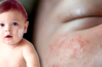 Newborn Skincare: Parents Should Avoid These 6 Common Mistakes