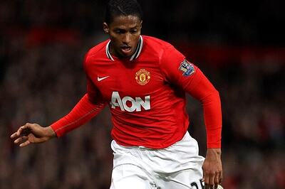 Valencia does not require surgery: Ferguson