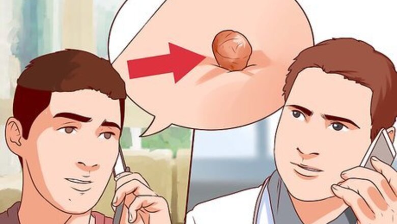 How to Get a Skin Tag Removed by a Doctor