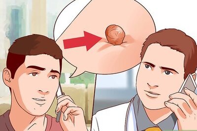 How to Get a Skin Tag Removed by a Doctor