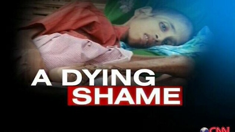 Maharashtra admits to large scale child malnutrition deaths