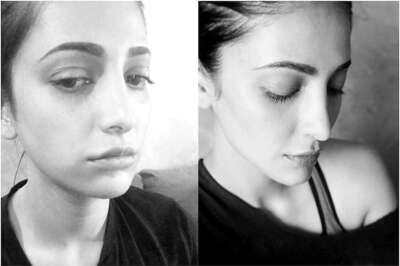 Shruti Haasan Undergoes Plastic Surgery, Shuts Down Trolls Saying Not Ashamed to Admit