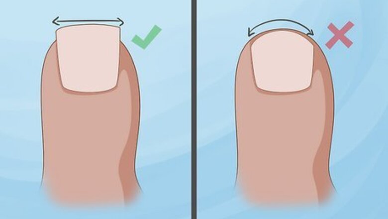 How to Prevent Ingrown Nails