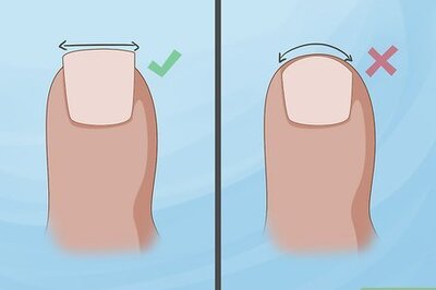 How to Prevent Ingrown Nails