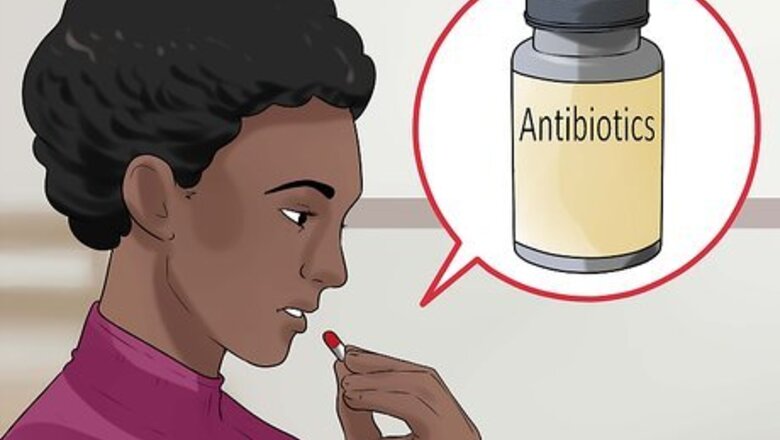 How to Treat Gastric Ulcer