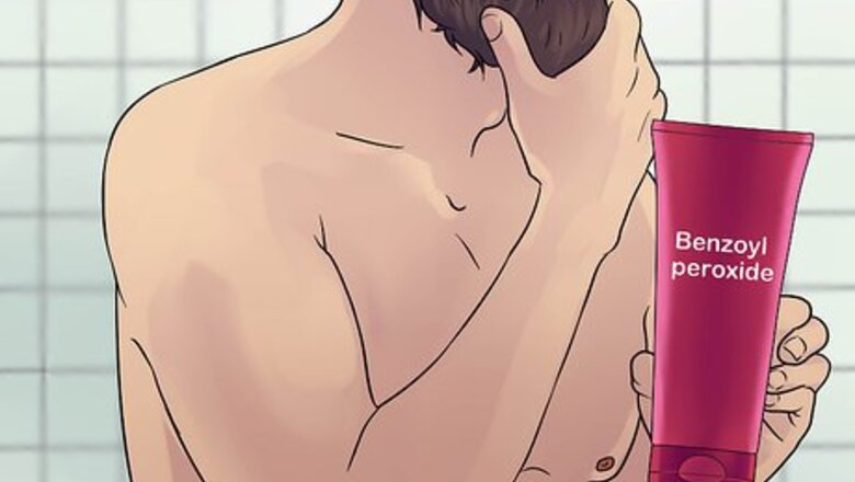 How to Prevent Chest Acne