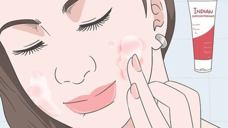 How to Treat Rosacea: Can Herbal Remedies Help?