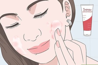 How to Treat Rosacea: Can Herbal Remedies Help?