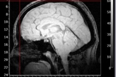 Imaging techniques may spot dementia