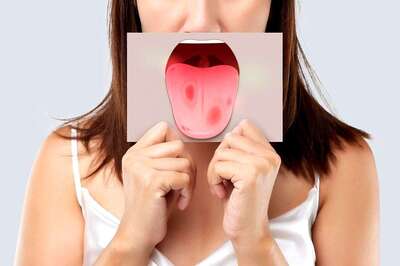 The Importance of Regular Self-Examination for Early Oral Cancer Detection