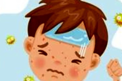 Mumbai Sees 24 Fresh Measles Cases and One Suspected Death: BMC