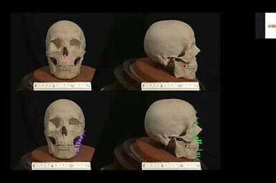 Raphael did a nose-job in self-portrait, face reconstruction suggests