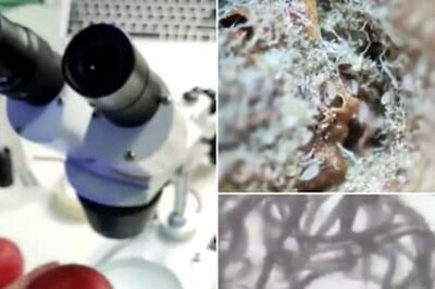 Watch: Man Examines Objects With Microscope, Finds A Colony Of Germs