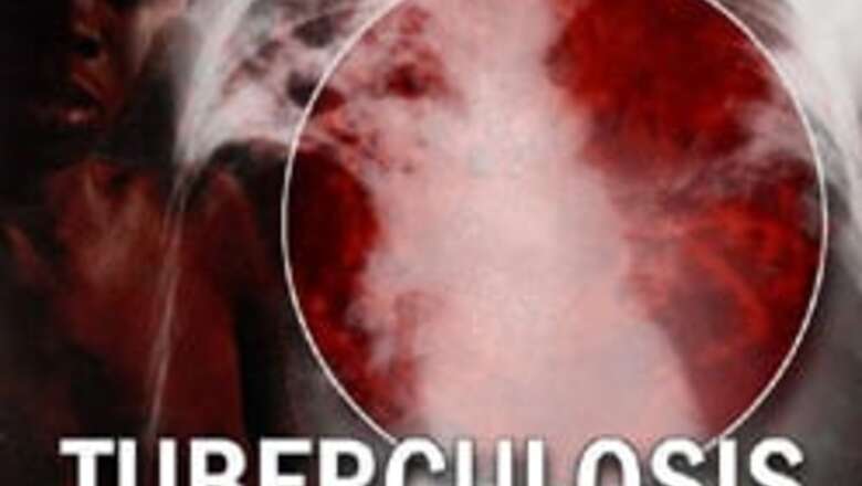 Older version vaccines better at preventing TB
