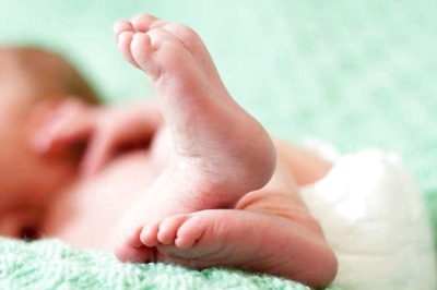 Baby Born With Four Legs at Government Hospital in Kakinada