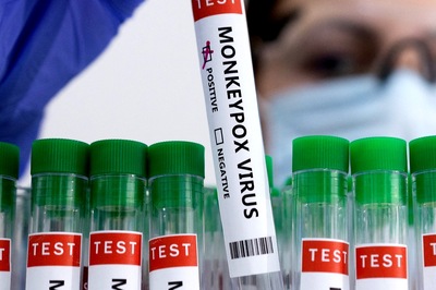 Monkeypox: 'Viruses Don’t Care About Sexual Orientation, Race', Experts Caution Against Stigmatisation