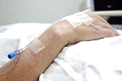 Skin Cancer Deaths Higher in Men Than in Women