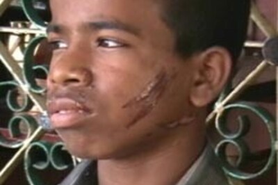 12-yr-old attacked for eating biscuit without permission