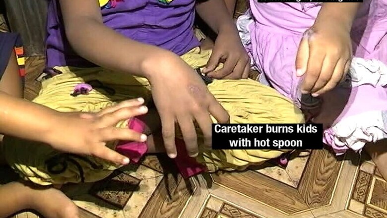 Caretaker Burns Hands of Kids With Hot Spoon in Telangana