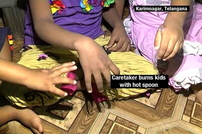 Caretaker Burns Hands of Kids With Hot Spoon in Telangana