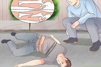 How to Realign a Fractured Bone