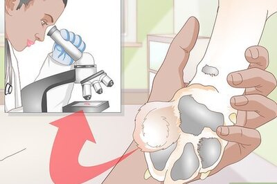 How to Get Fatty Tumors Removed in Dogs