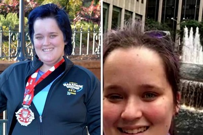 This US Woman's Brain Tumor Was Disclosed Through Selfie Taken On Vacay