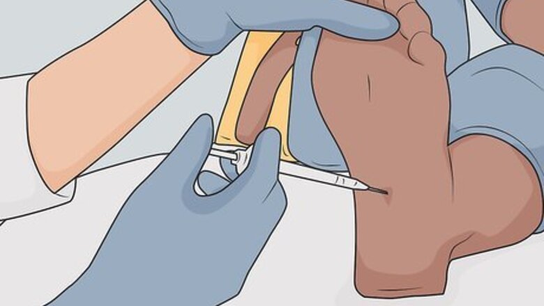 Getting Bunion Surgery? Your Most Important Questions Answered