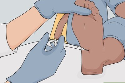 Getting Bunion Surgery? Your Most Important Questions Answered