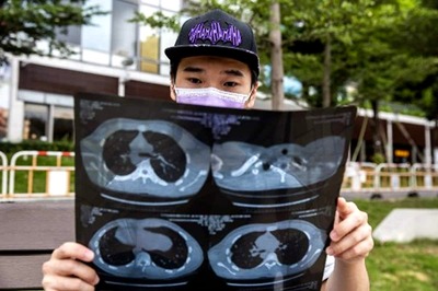 Hong Kong Student Shot by Police During Last Year's Protests Goes on the Run Ahead of Trial