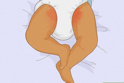 How to Relieve Diaper Rash Fast