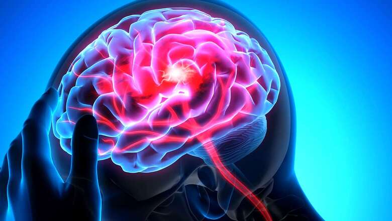 Study: COVID-19 Triggers Brain Inflammation Similar to Parkinson’s and Other Neurodegenerative Conditions