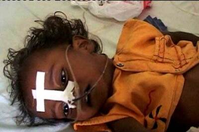 Encephalitis claims 11 more lives in 3 days; toll climbs to 330