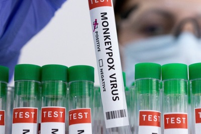 Health Matters | Test, Track, Trace: Time to Revise Learnings from Covid Outbreak to Tackle Monkeypox