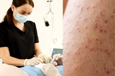 Chicken Skin: Know Its Causes And Preventive Measures