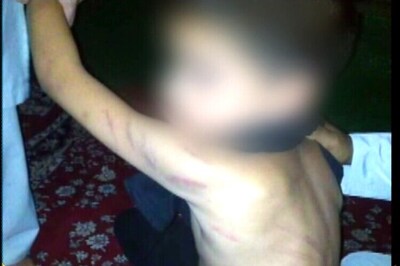 J&K: Teacher beats class 2 student with stick for shouting in class, arrested