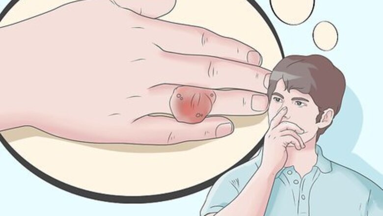 How to Lower Uric Acid to Get Rid of Gout