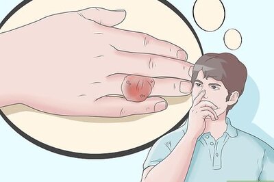 How to Lower Uric Acid to Get Rid of Gout